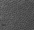 7 - Cellule epitalliche in visione superficiale